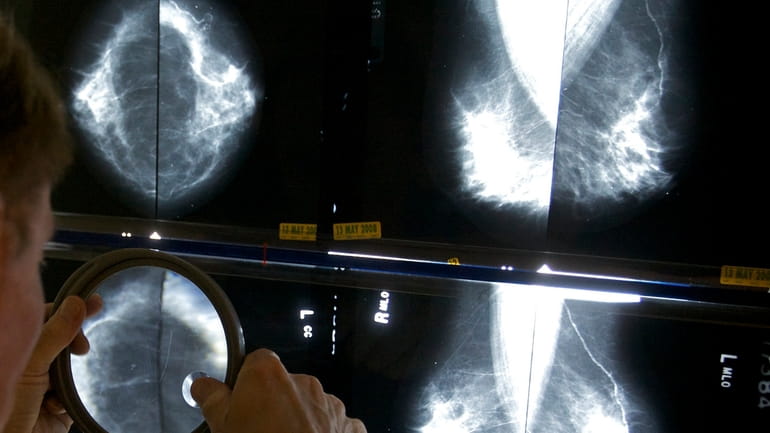 A radiologist uses a magnifying glass to check mammograms for...