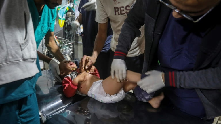A Palestinian child wounded in the Israeli bombardment of the...
