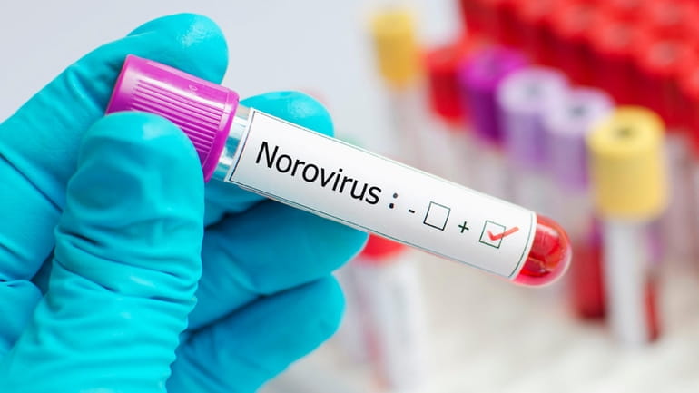 A blood sample tests positive for Norovirus.