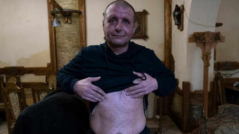 42-year-old Vyacheslav Ryabkov, an internally displaced person from Kozachi Laheri...