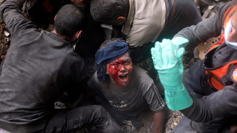 An injured Palestinian boy cries as rescuers try to pull...