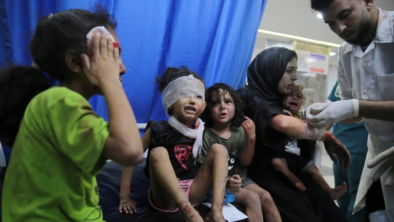 Palestinian children wounded in Israel strikes are brought to Shifa...
