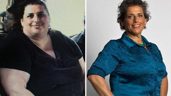 Melanie Cirulnick, of Oceanside, lost 155 pounds from 2007 to...