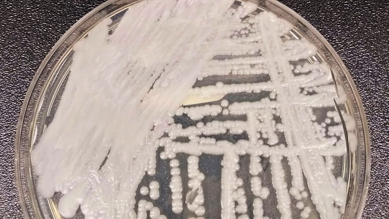 A strain of Candida auris cultured in a petri dish...