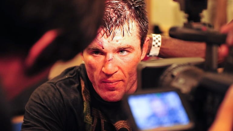 Trust us when we say Chael Sonnen looks better here...