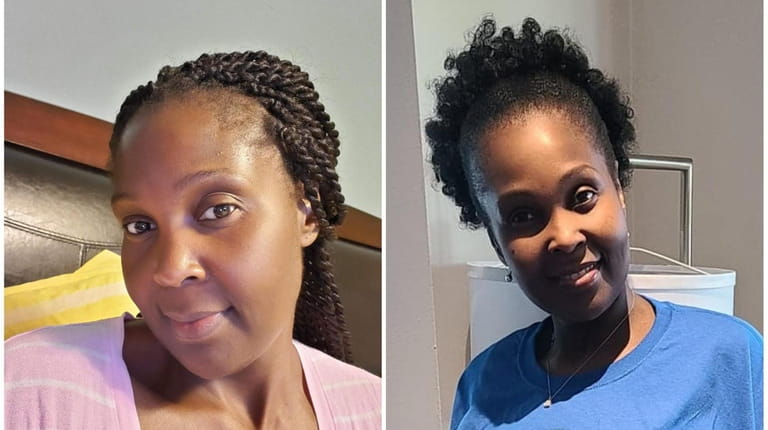 Maria Beckles-Gordon, 44, of Valley Stream, took her braids out...