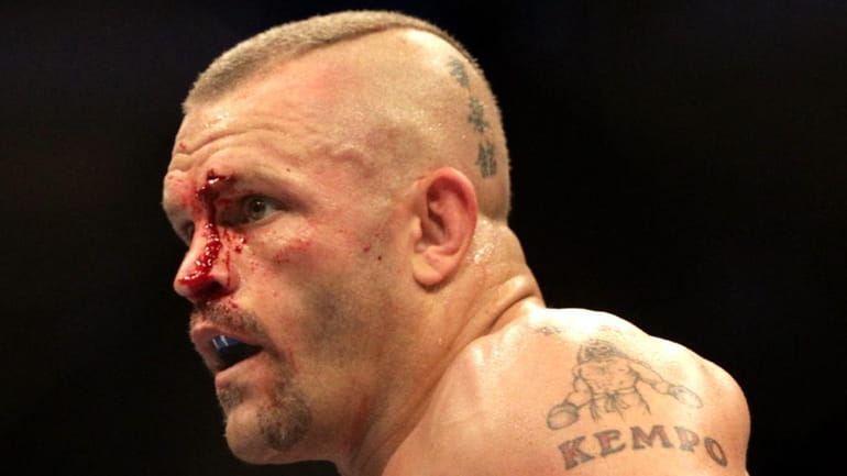 A bloodied Chuck Liddell during his match against Rich Franklin...