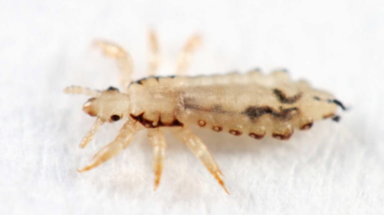 When it comes to head lice, business is booming.
