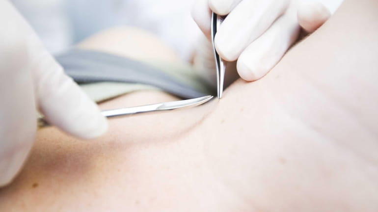 Americans spent more than $12 billion on cosmetic procedures in...