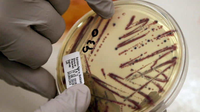 A microbiologist points out an isolated E. coli growth on...