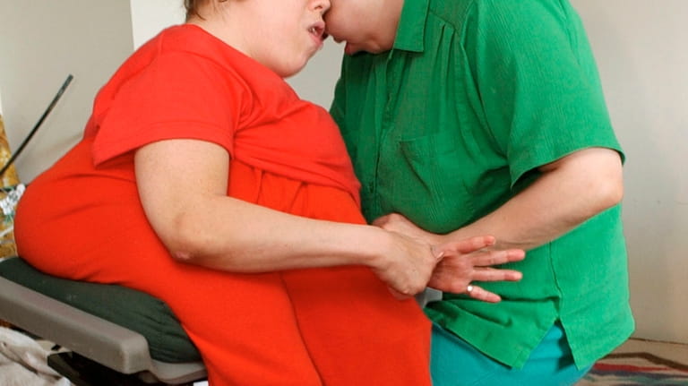 Conjoined 40-year-old twins George, left, and Lori Schappell are seen...