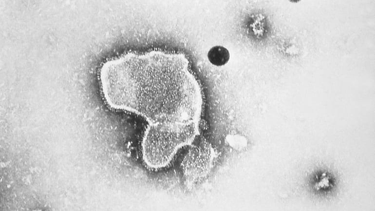 An electron micrograph of Respiratory Syncytial Virus, or RSV, provided...