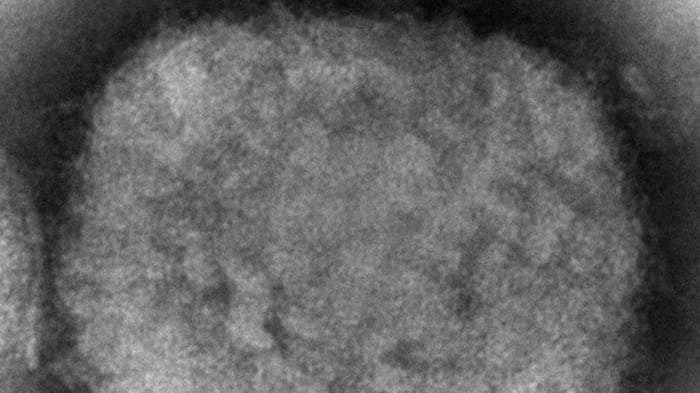 A monkeypox virion is shown in this 2003 electron microscope image...