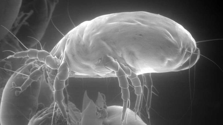 A house dust mite as seen with an electron microscope,...