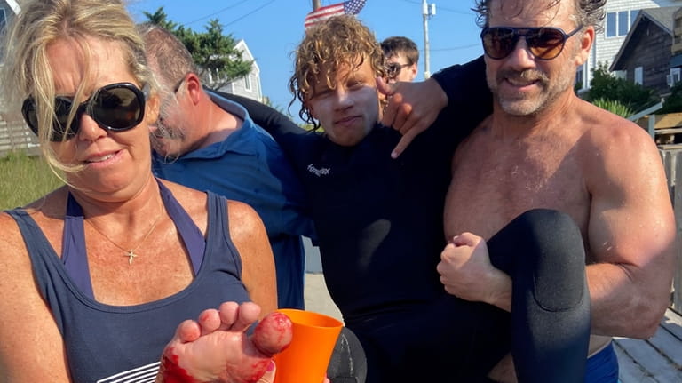 Max Haynes is carried after he was bitten by a shark...