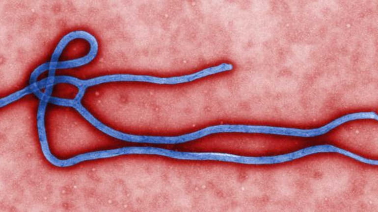 Ebola can be hard to diagnose because early symptoms, including...